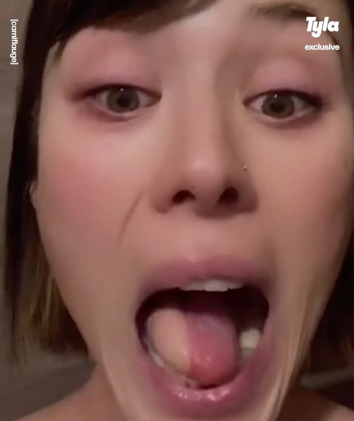 Cameron was left in shock after discovering hair growing from her tongue.