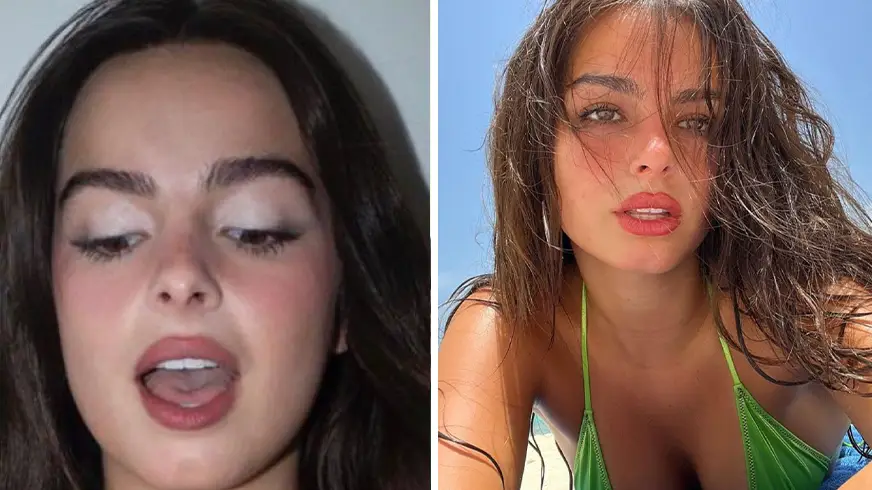 Adidas/Instagram/addisonraee