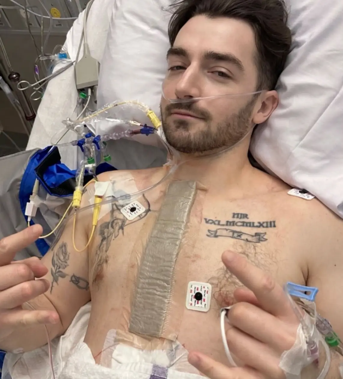 Liam Neeson's son Daniel has shared a health update on social media after undergoing surgery (Instagram/@bgdans91)