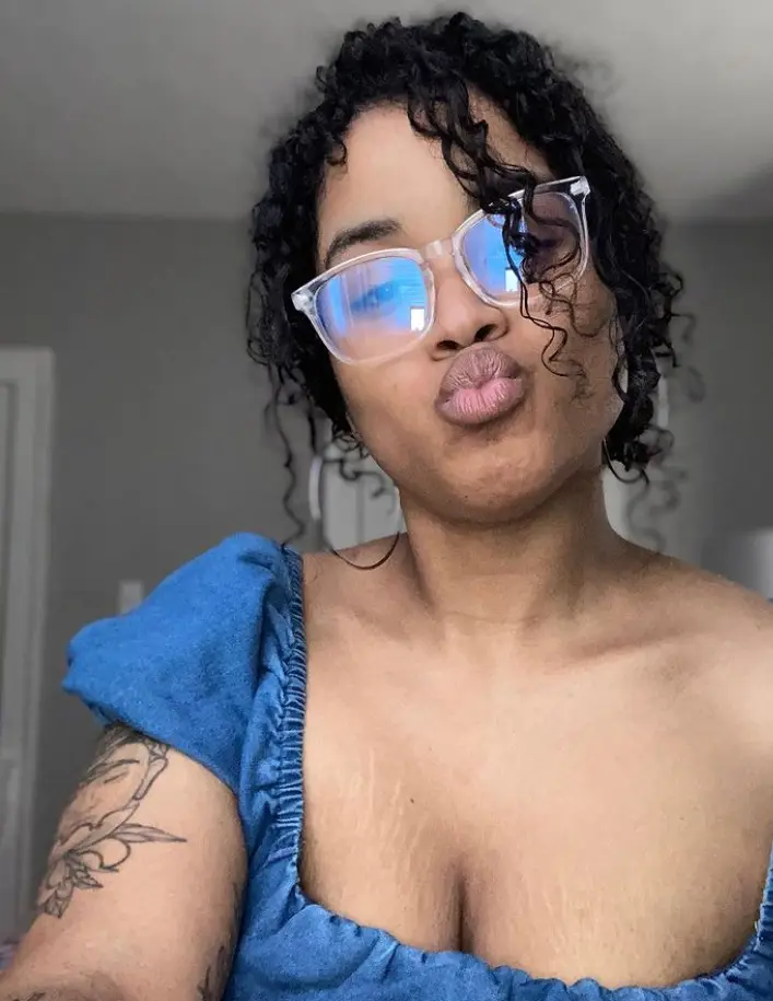 The condition affects Mahogany's entire left side.