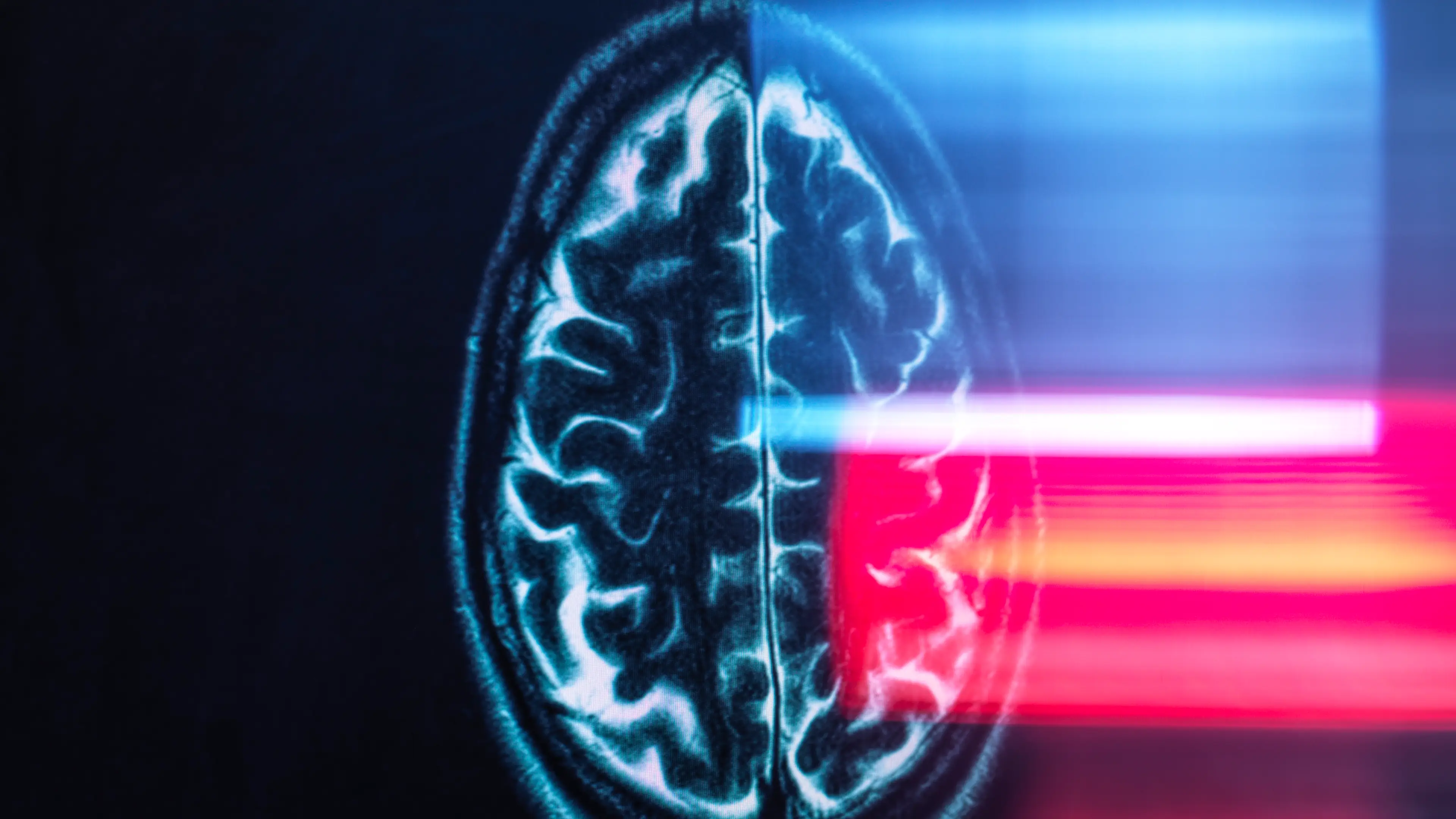 Neurologist reveals key warning sign of dementia that can appear ‘early’ while watching TV series