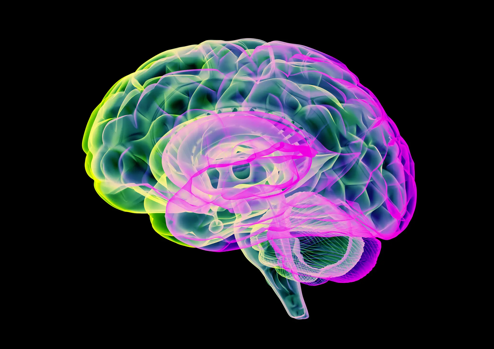 As many as 1 in 11 people over the age of 65 have dementia (THOMAS PARSONS/SCIENCE PHOTO LIBRARY / Getty Images)