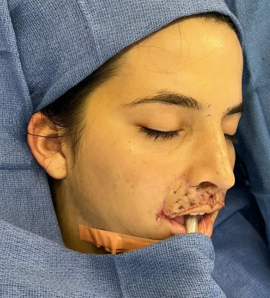 Brooklinn admitted she was apprehensive before the surgery.