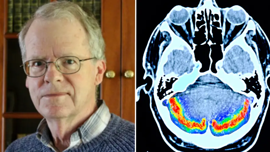 Dementia Researcher/Getty Stock Images