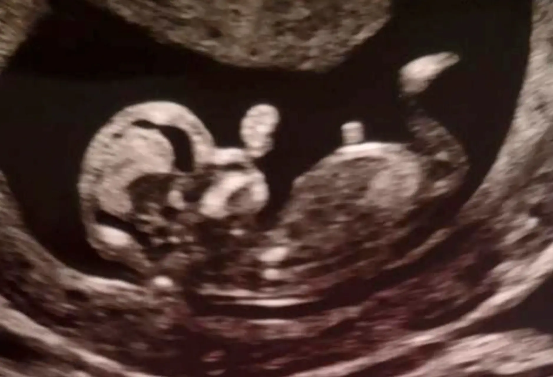 Following his death, Rob's family have announced that his girlfriend Jade Higgins is pregnant.