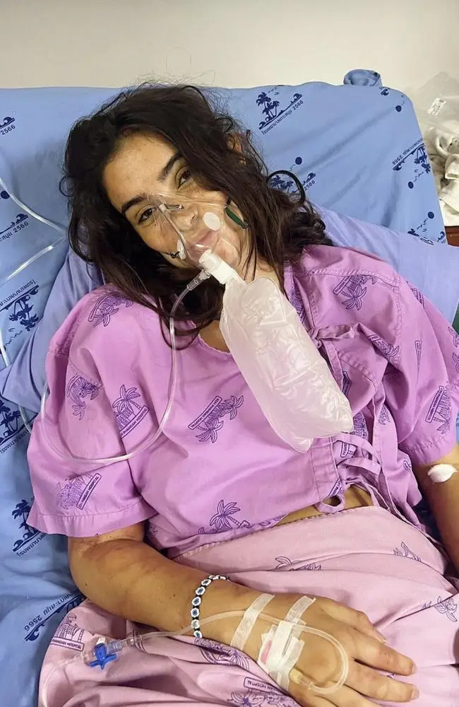 Zoe Cahill has opened up about being stung by a jellyfish on holiday.