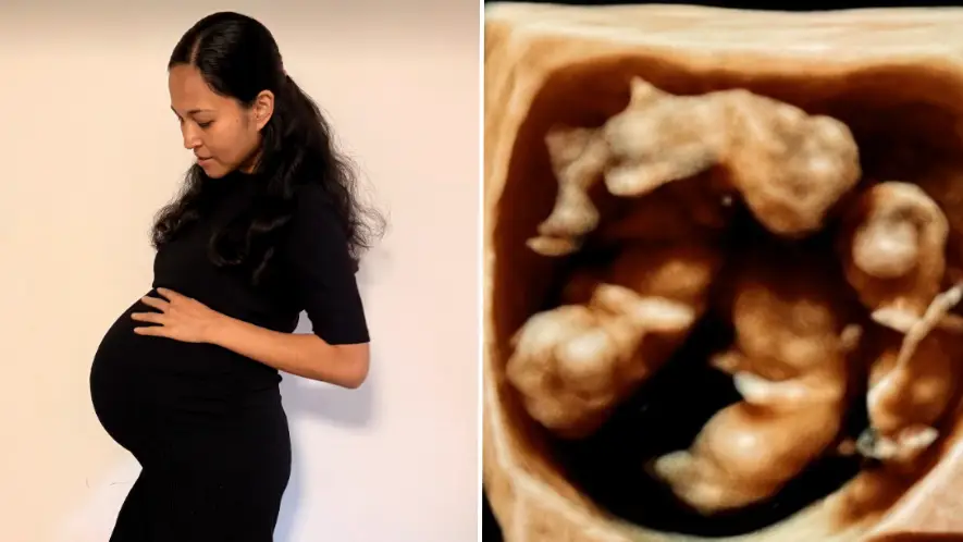 Australian mum, 34, gives birth to quadruplet babies in extremely rare way