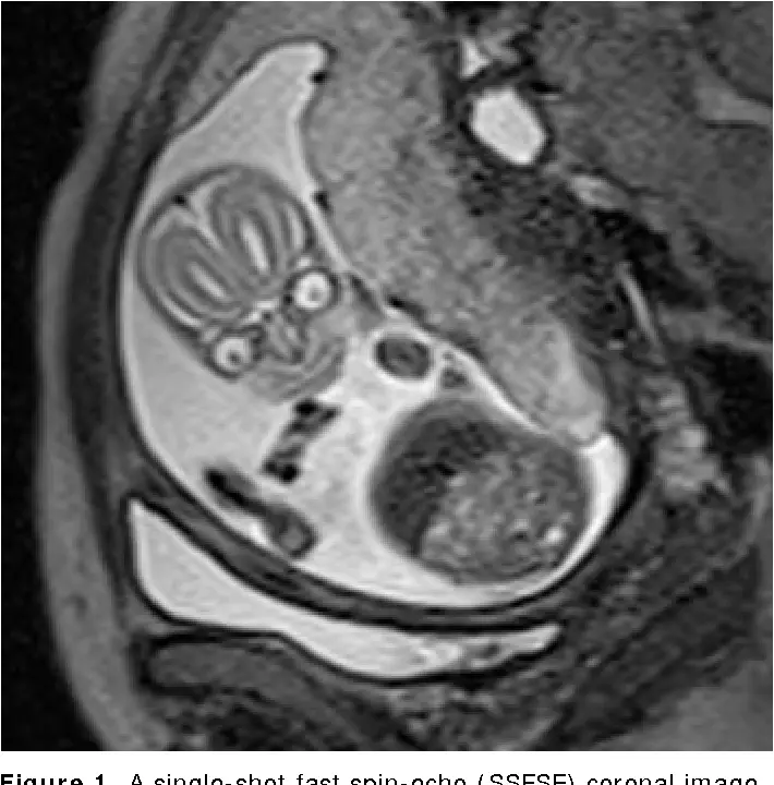 Time to be frightened (Semantics Scholar)