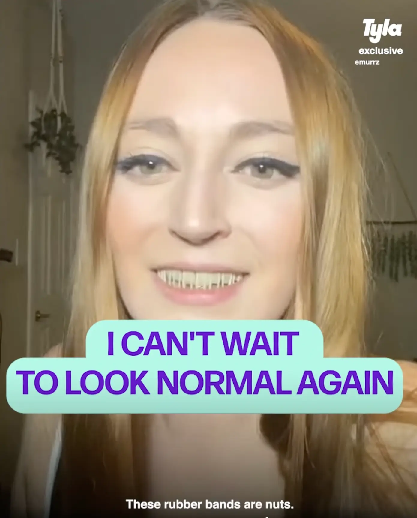 Caroline's rubber bands.