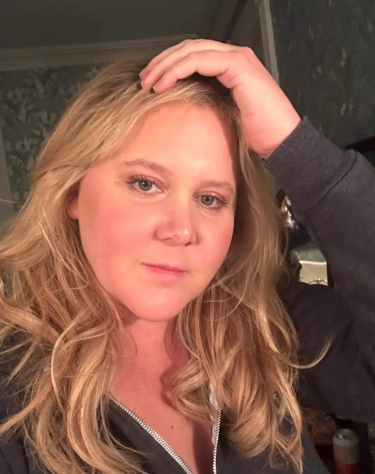 Schumer was diagnosed with Cushing's disease (Instagram/@amyschumer)