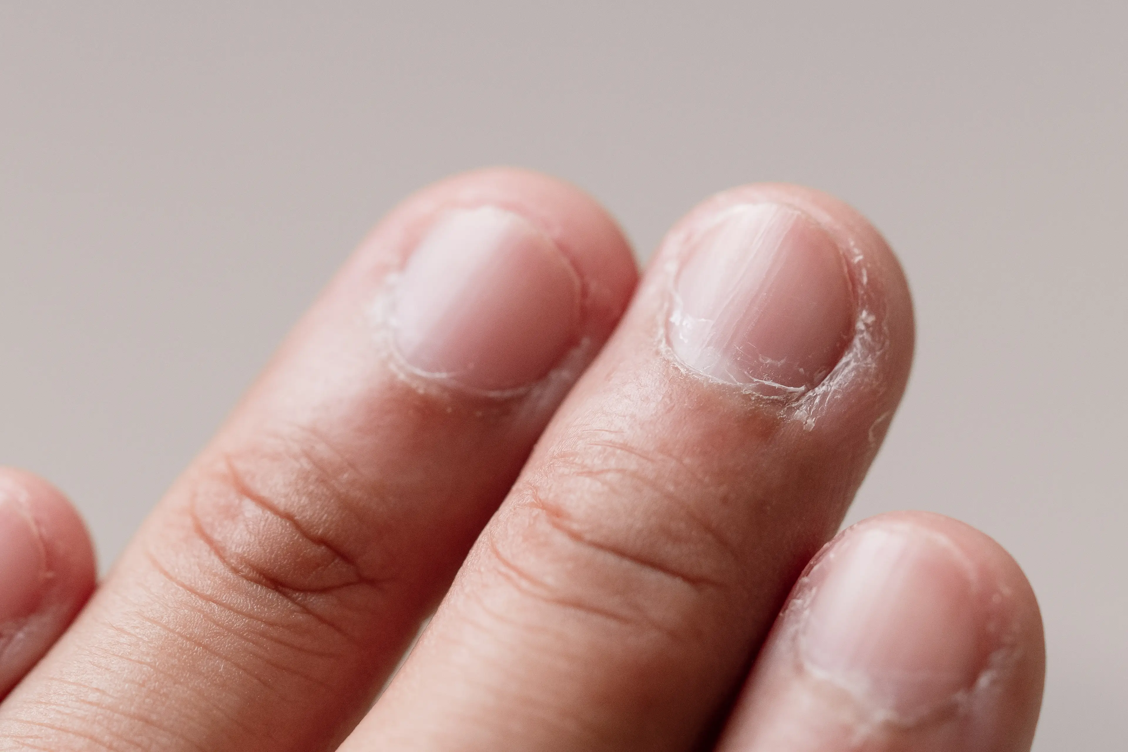 The common habit might not be as harmless as you think (Getty Stock Images)