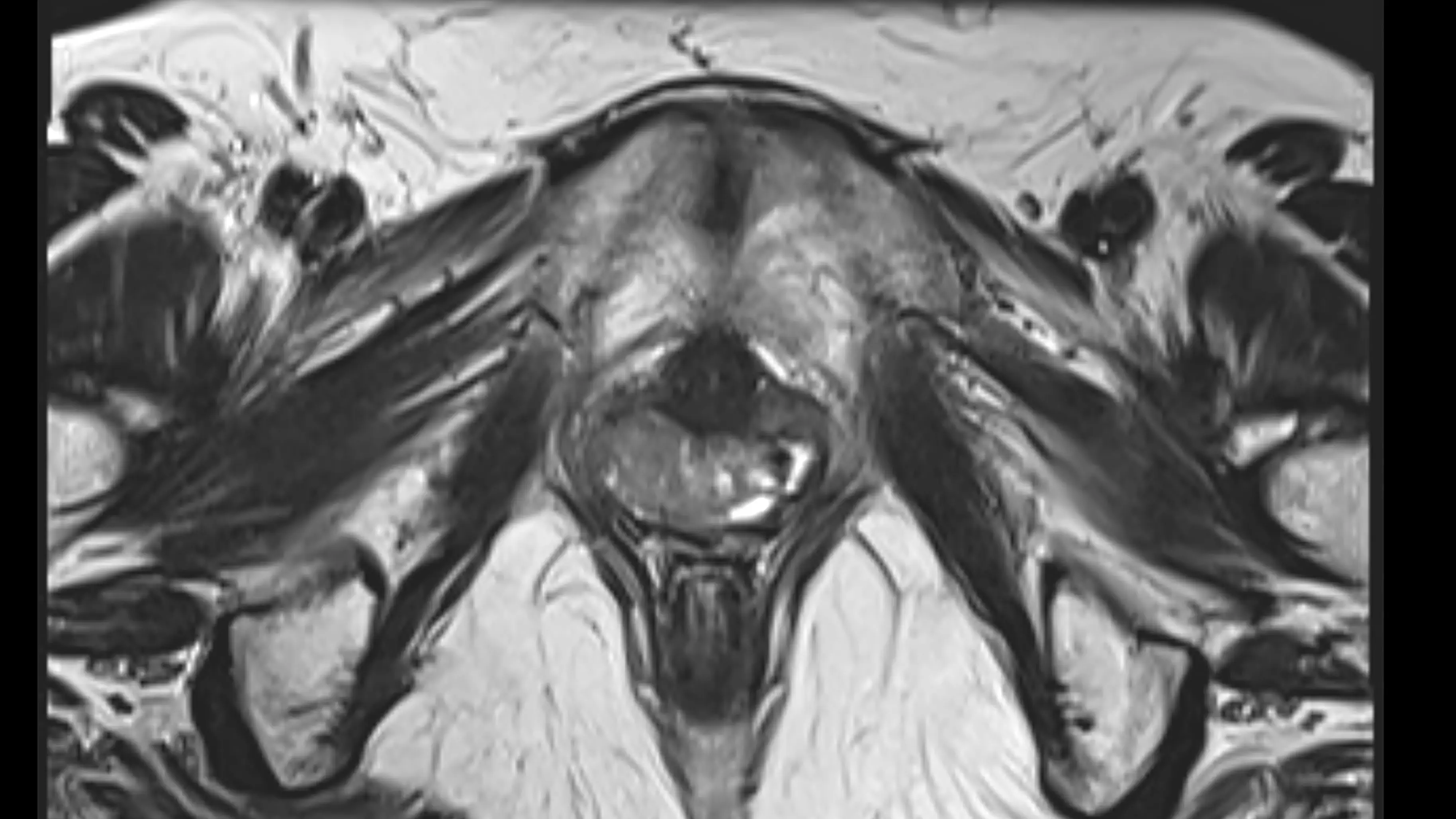 Worst things that got stuck up people's vaginas last year revealed by government