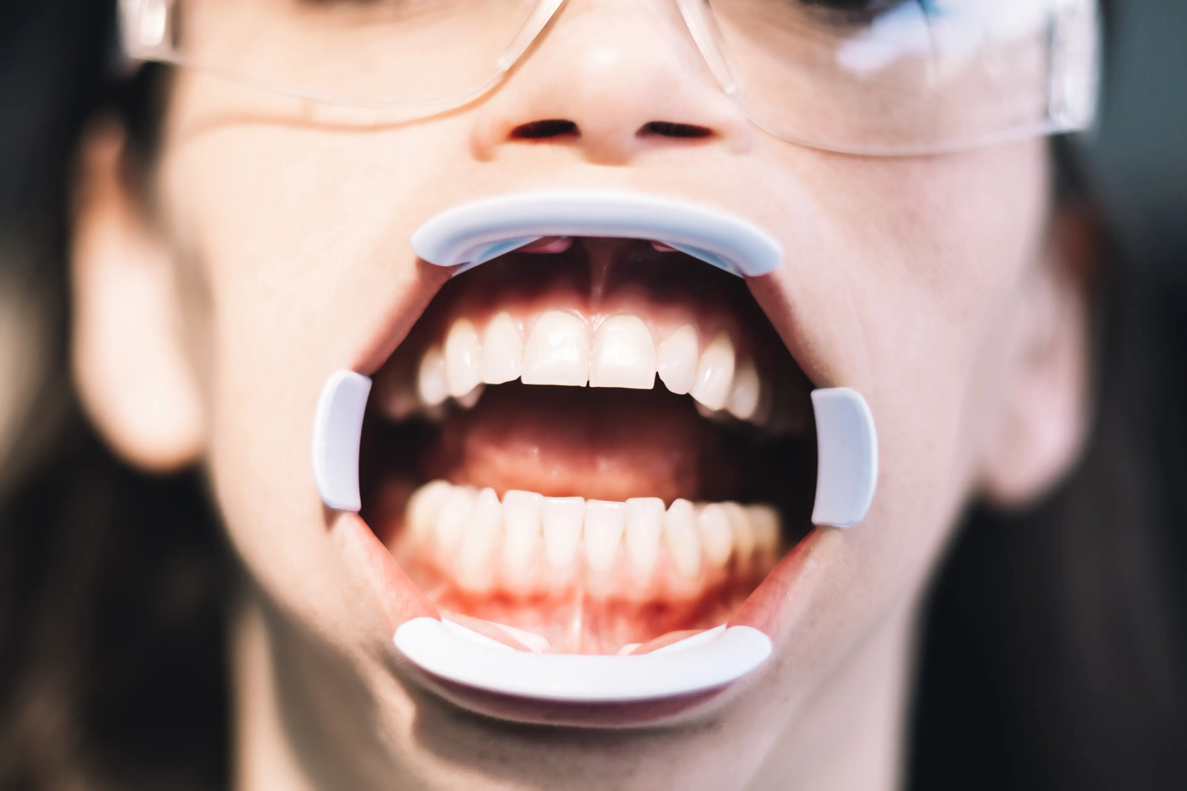 Do you brush your teeth before or after breakfast? (Getty Stock)