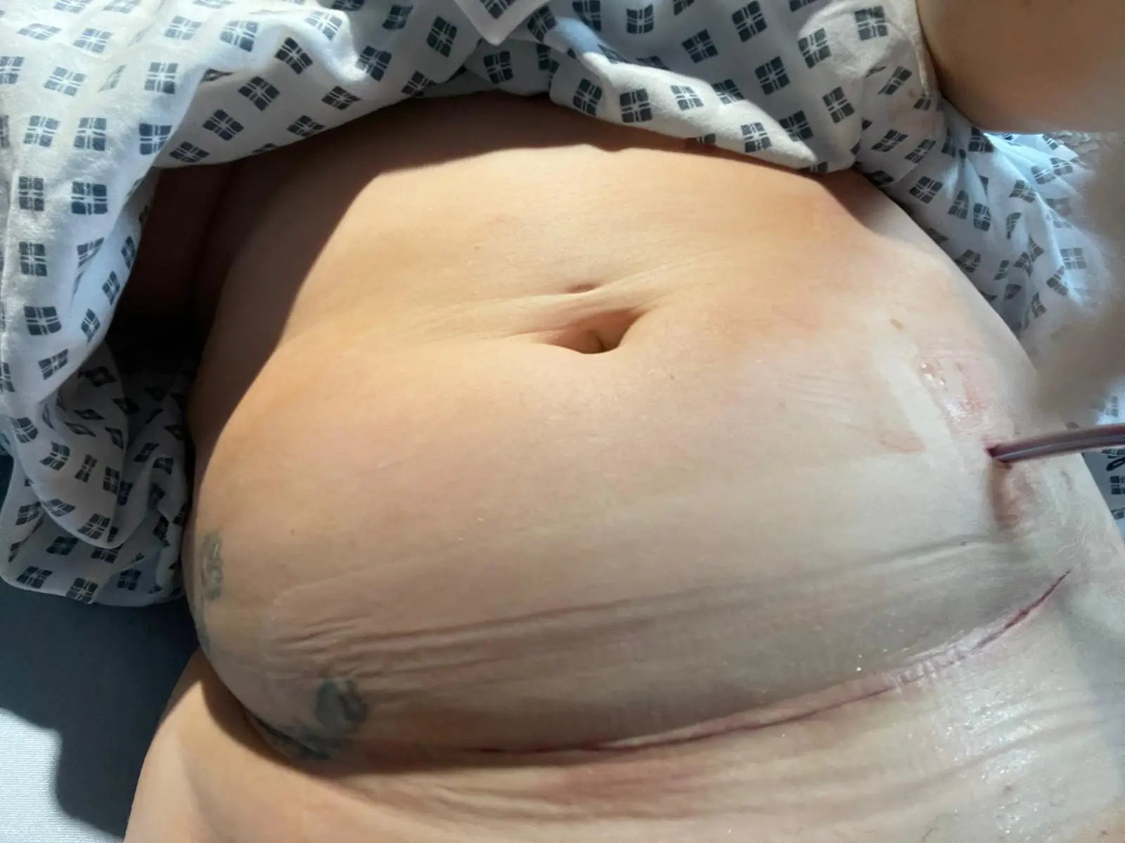 Abigail wants to help others, even though it's too late for her to have a family.