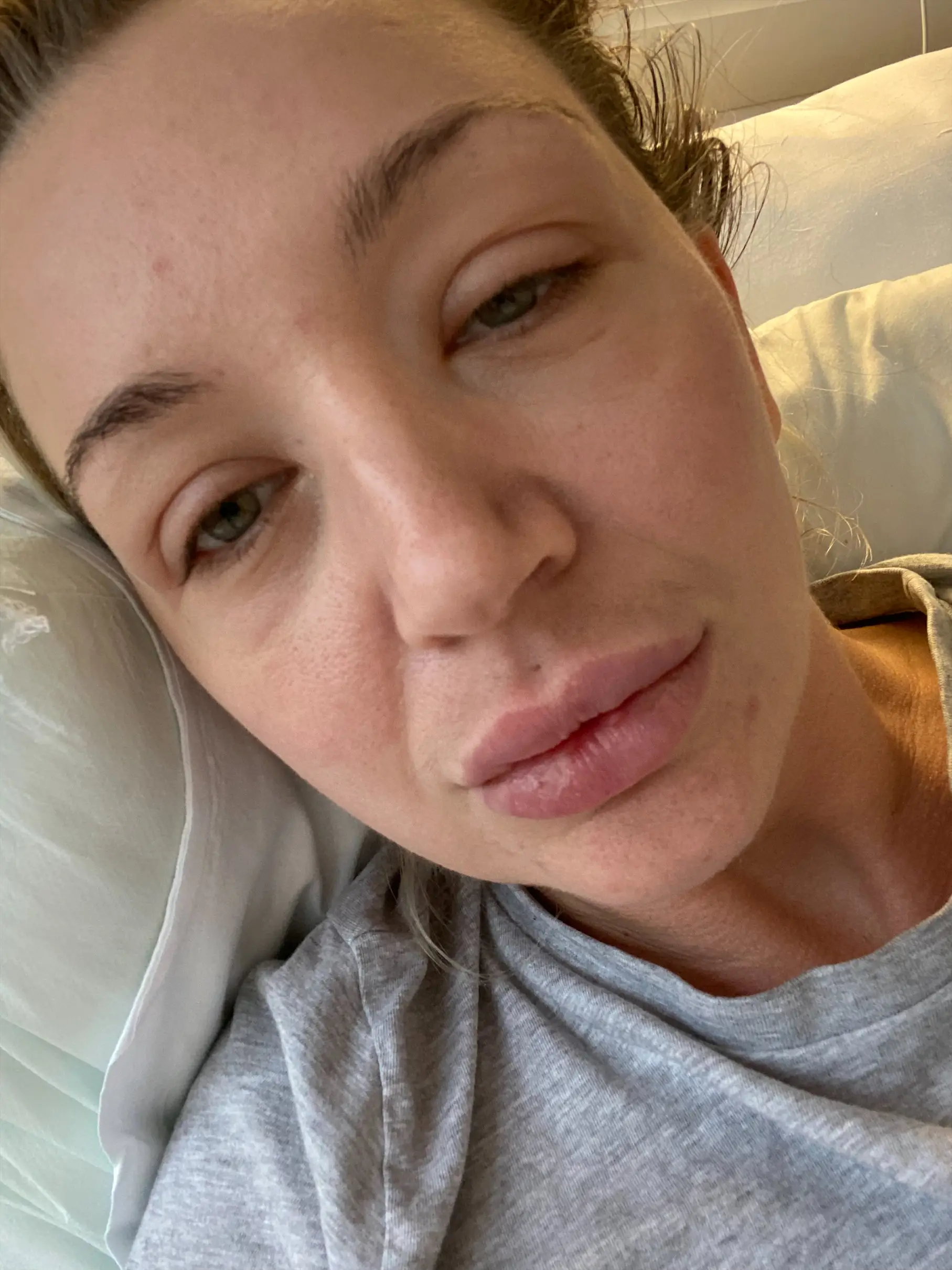 The mum needed extensive surgery after developing gangrene.