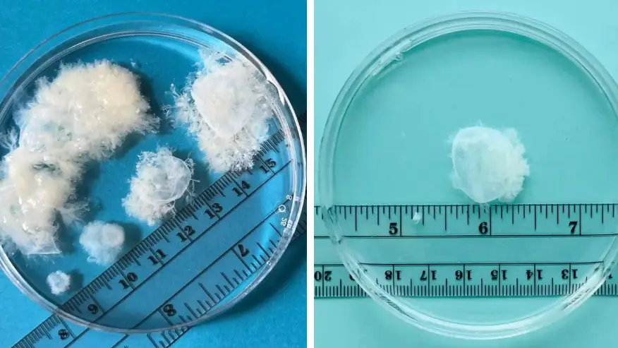 Woman shares what early abortions actually look like
