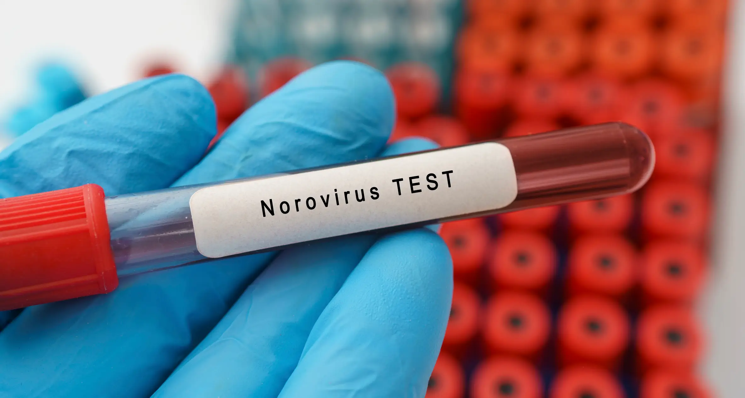 Samples are being tested to confirm the cause of the outbreak (WLADIMIR BULGAR/SCIENCE PHOTO LIBRARY/Getty Images)