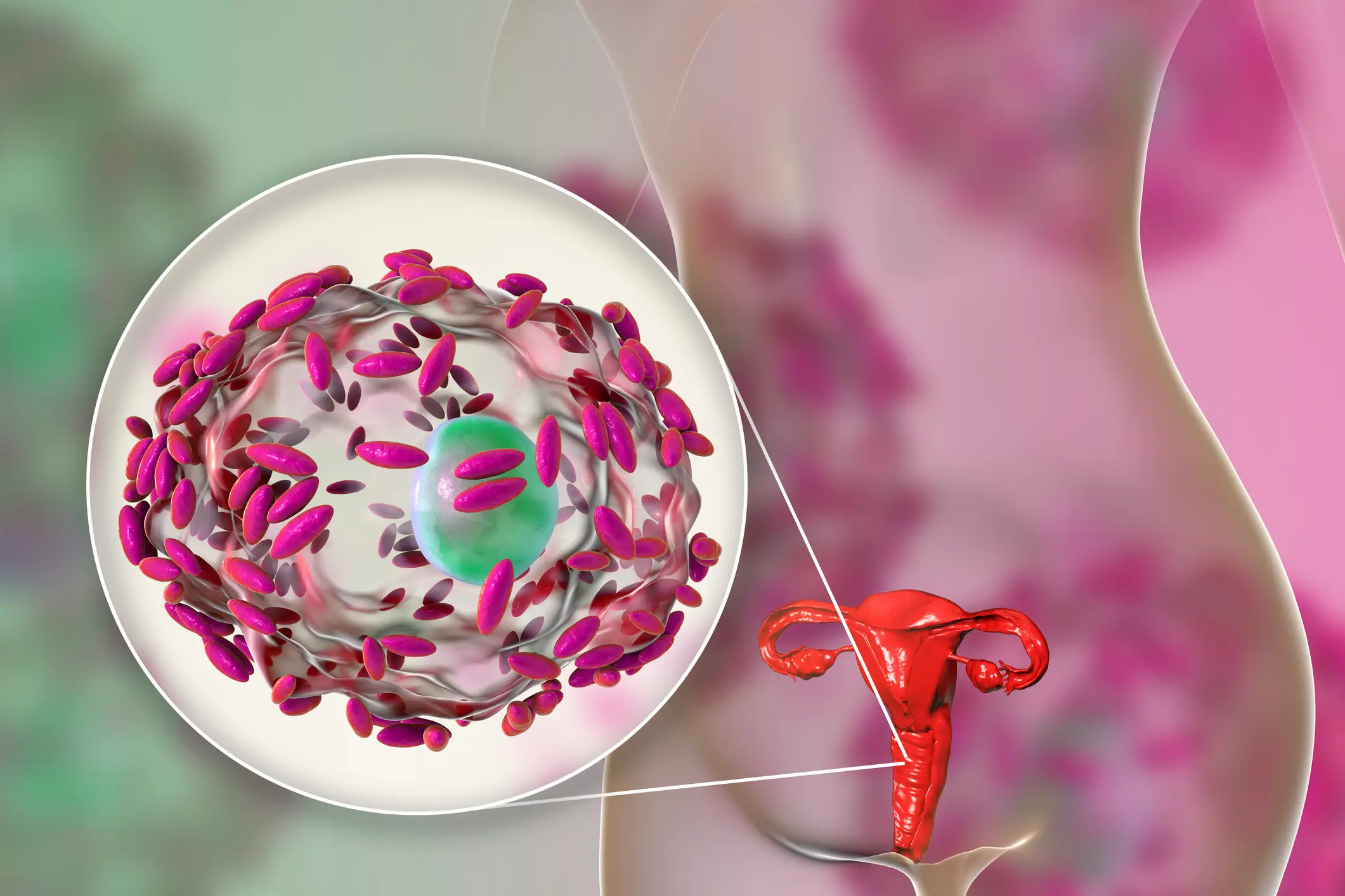 The new findings directly contradict the NHS's definitions of bacterial vaginosis (KATERYNA KON/SCIENCE PHOTO LIBRARY / Getty Images)