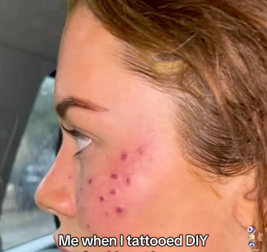 She bought tattoo ink online but it went horribly wrong (instagram/tillywhitfield)