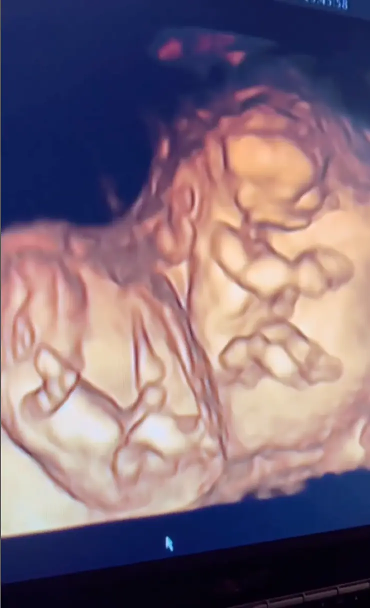 Ollie and Gareth are expecting twins.