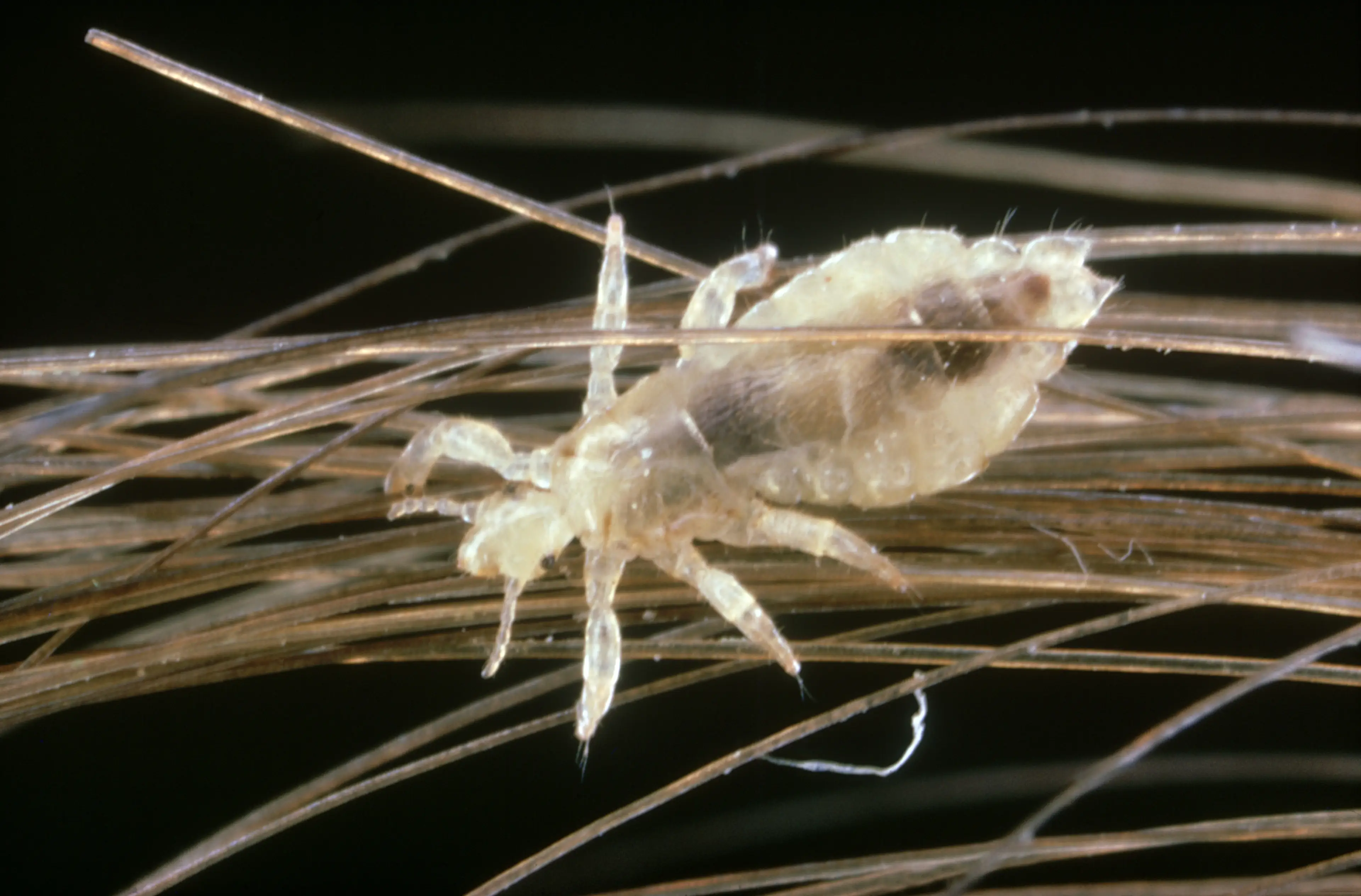 Head lice can be difficult to kill with straighteners alone.