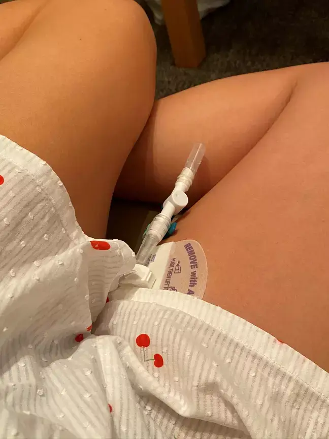 She has been told she’ll need to catheterise for life.