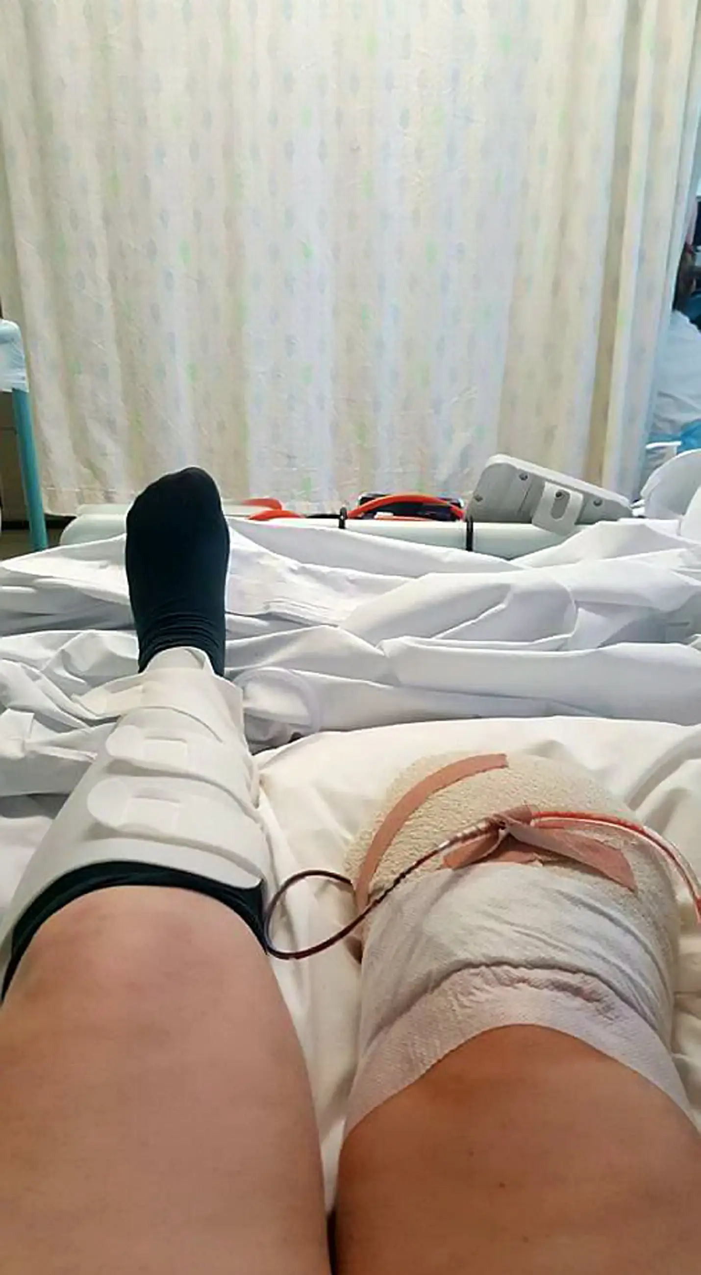 Gill now has a prosthetic leg and is planning to swim a mile for charity this June (SWNS)