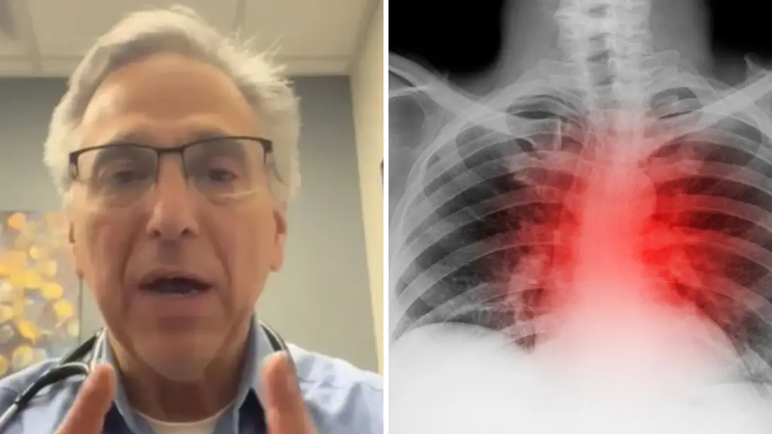 Getty Stock Image/ Dr. Evan S. Levine / TikTok