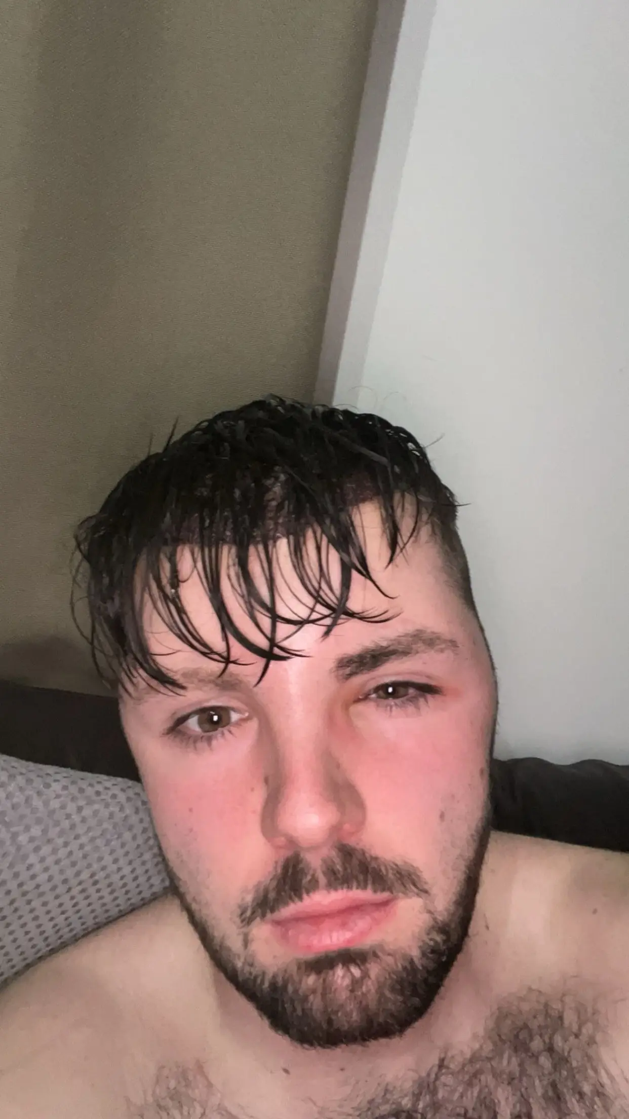 Ruben Owen, 24, woke up to realise the left side of his face had ballooned (SWNS)