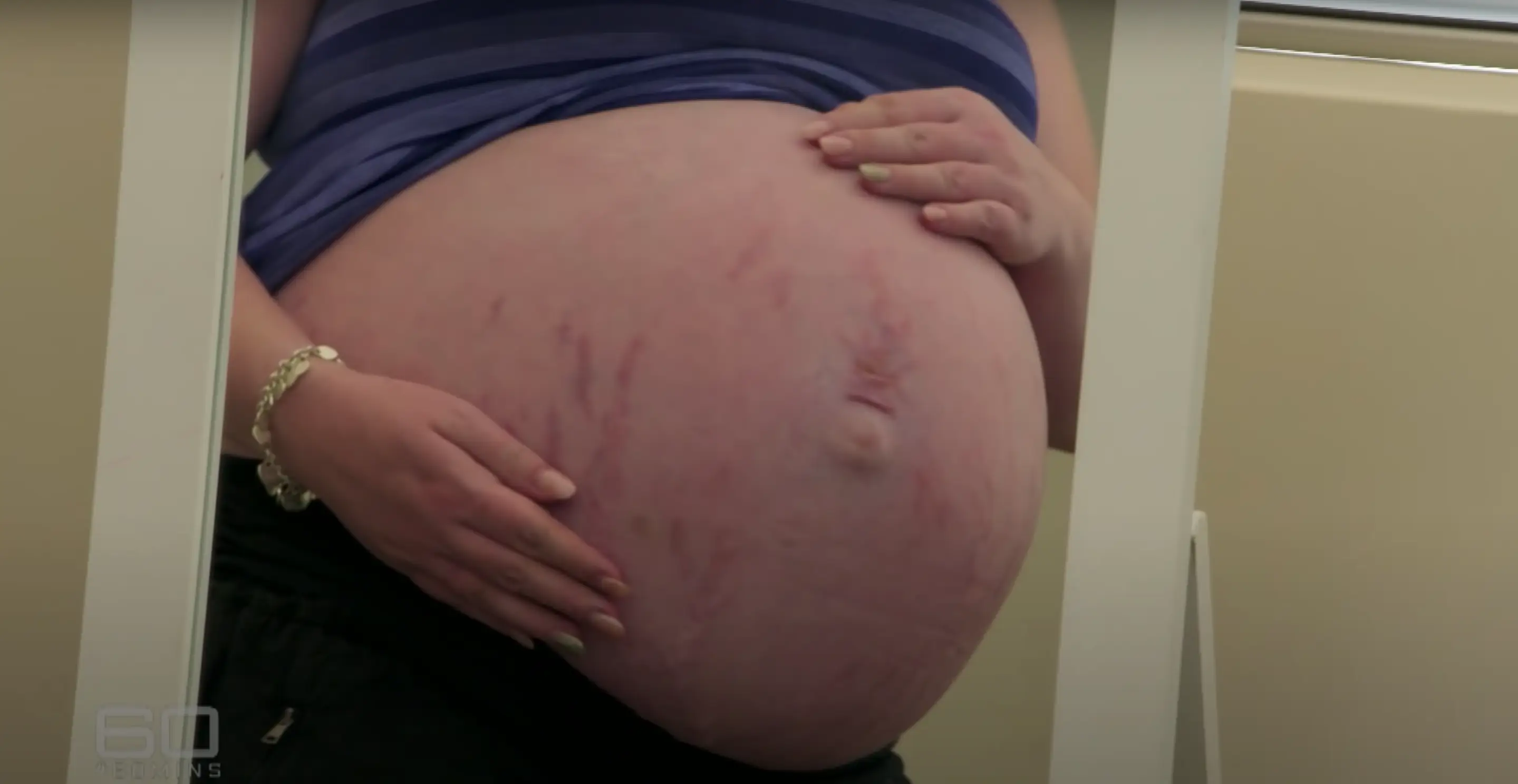 Kim was shocked when she was told there were five heartbeats.