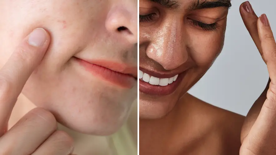 Why you might be noticing uneven skin tones on your body and simple ways to fix it