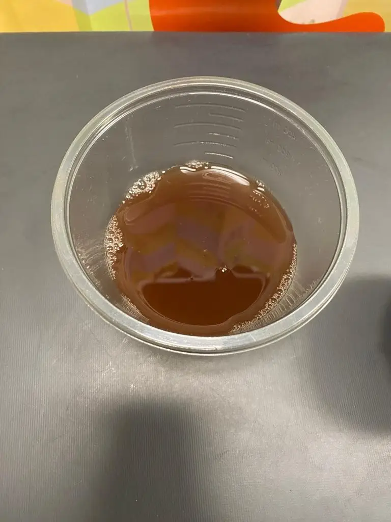 Stacie noticed Jaxon had 'really dark urine'.