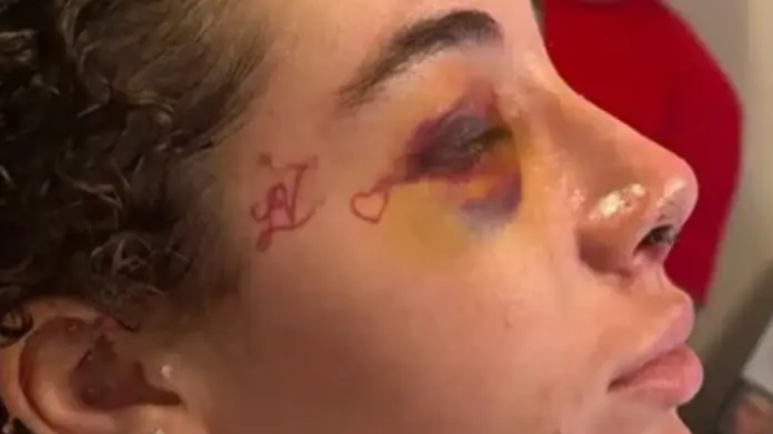 ‘Cash me outside’ star Bhad Bhabie reveals nose job results as she opens up on her cancer diagnosis