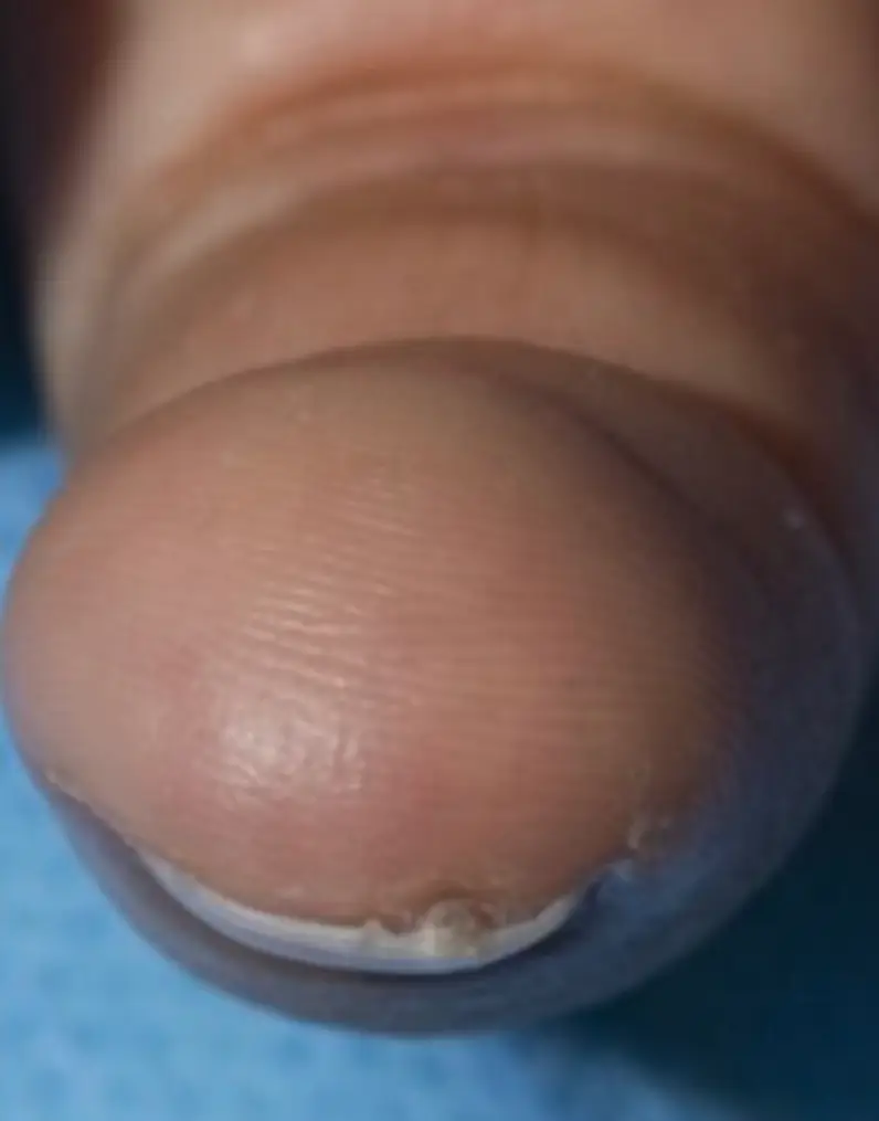 (Dermatology Consultation Service)