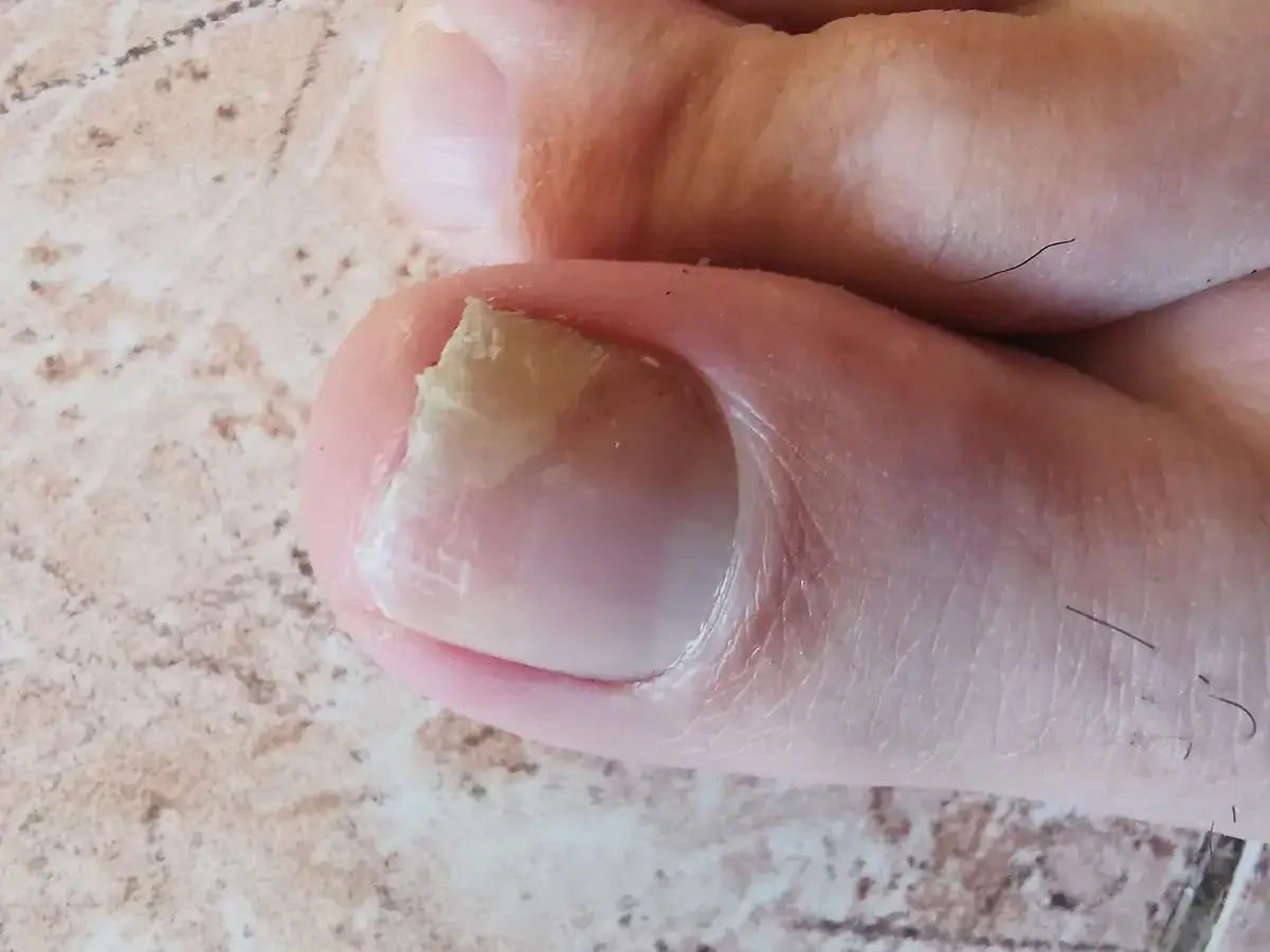 Even your nails could be an indicator (Getty stock images)