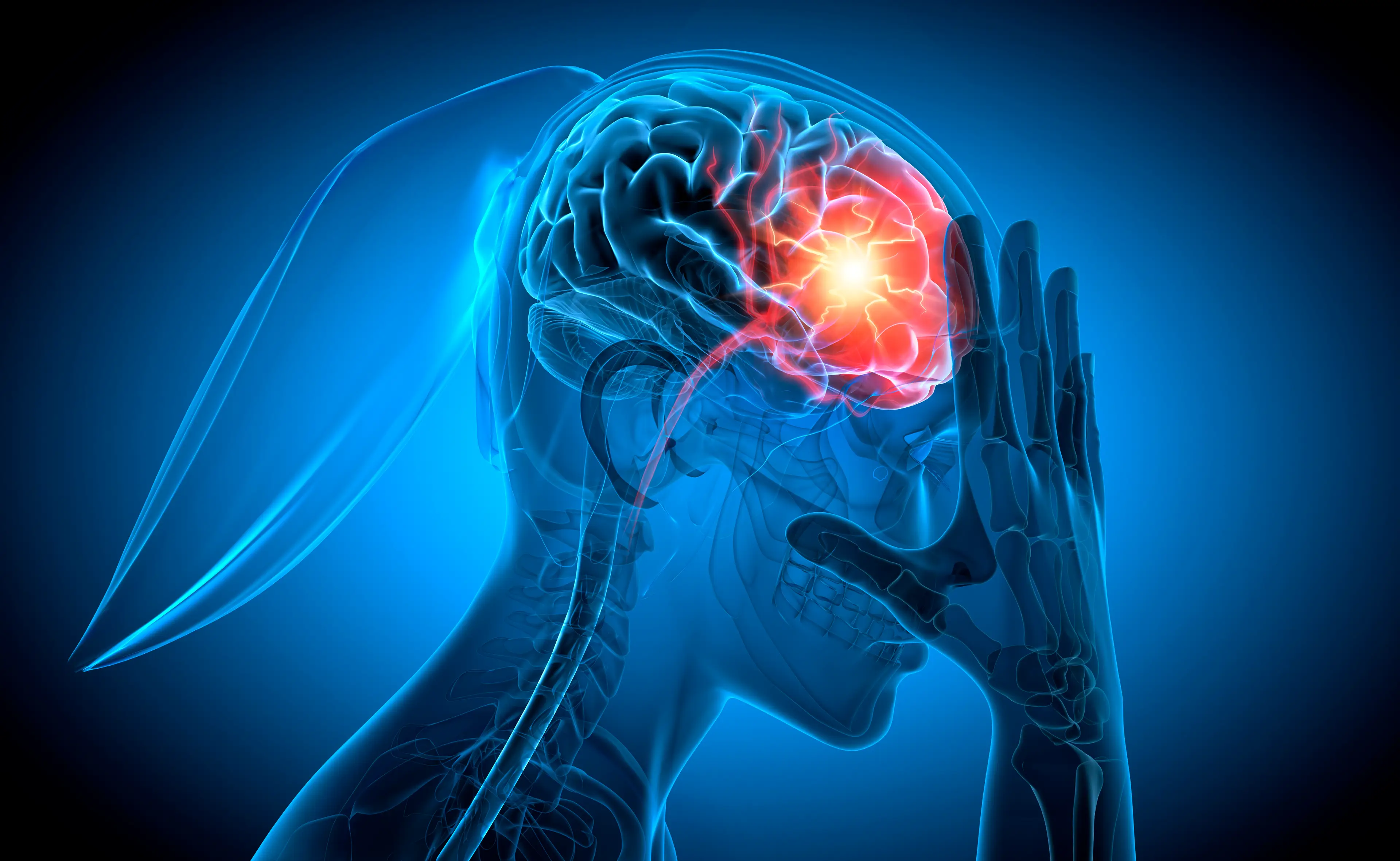 An ischemic stroke occurs when vessels that supply blood and oxygen to the brain are obstructed (Getty Stock Images)