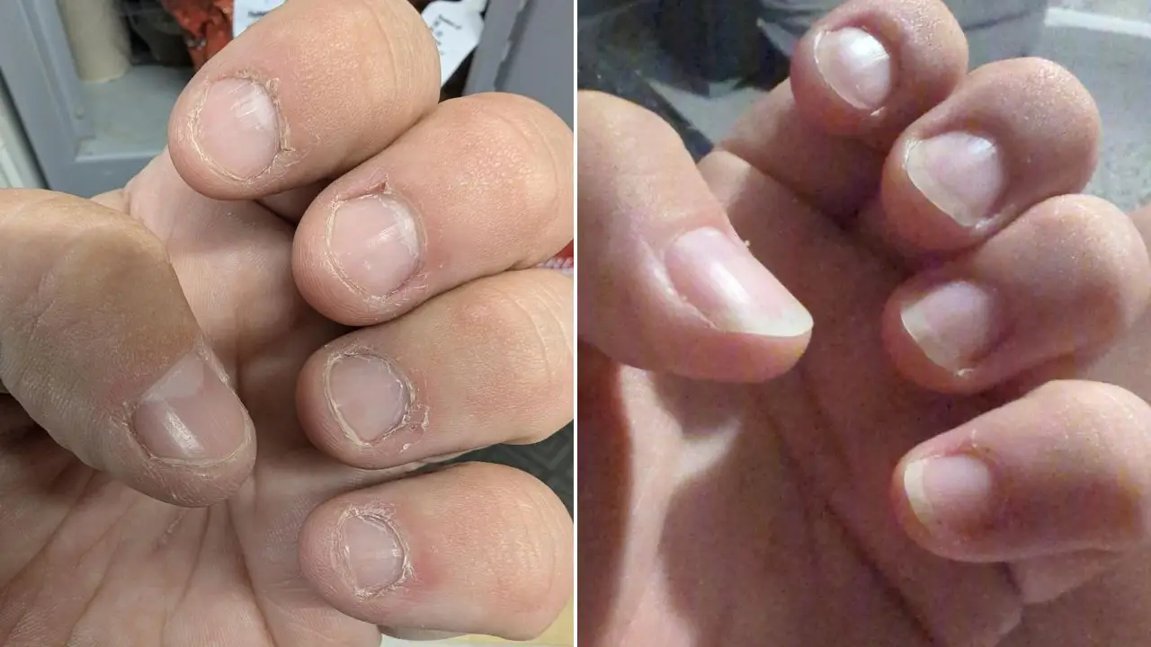 People say they've seen nail growth after just 'five weeks' (Amazon reviews)