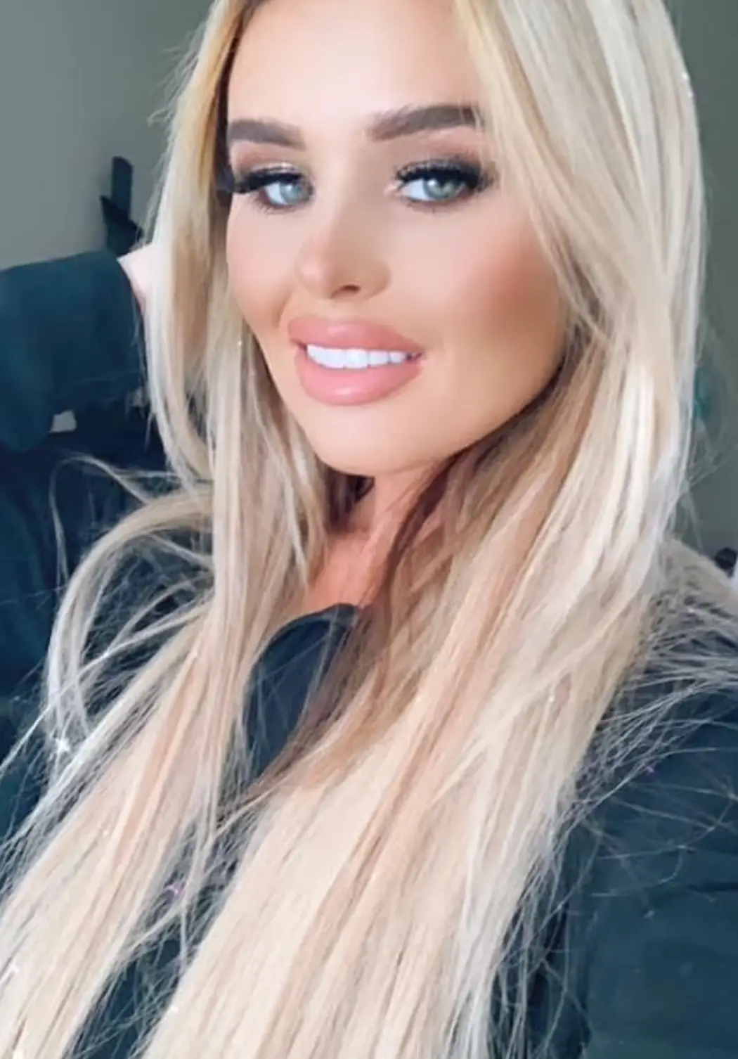 Franchesca Morgan was working as a nurse at Arrowe Park Hospital when she was caught stealing medication for a headache on two occasions. (Franchesca Morgan/Cavendish Press)