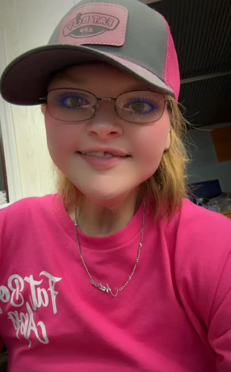 The skin removal surgery took over eight hours to complete (TikTok@tammy.l.slaton)