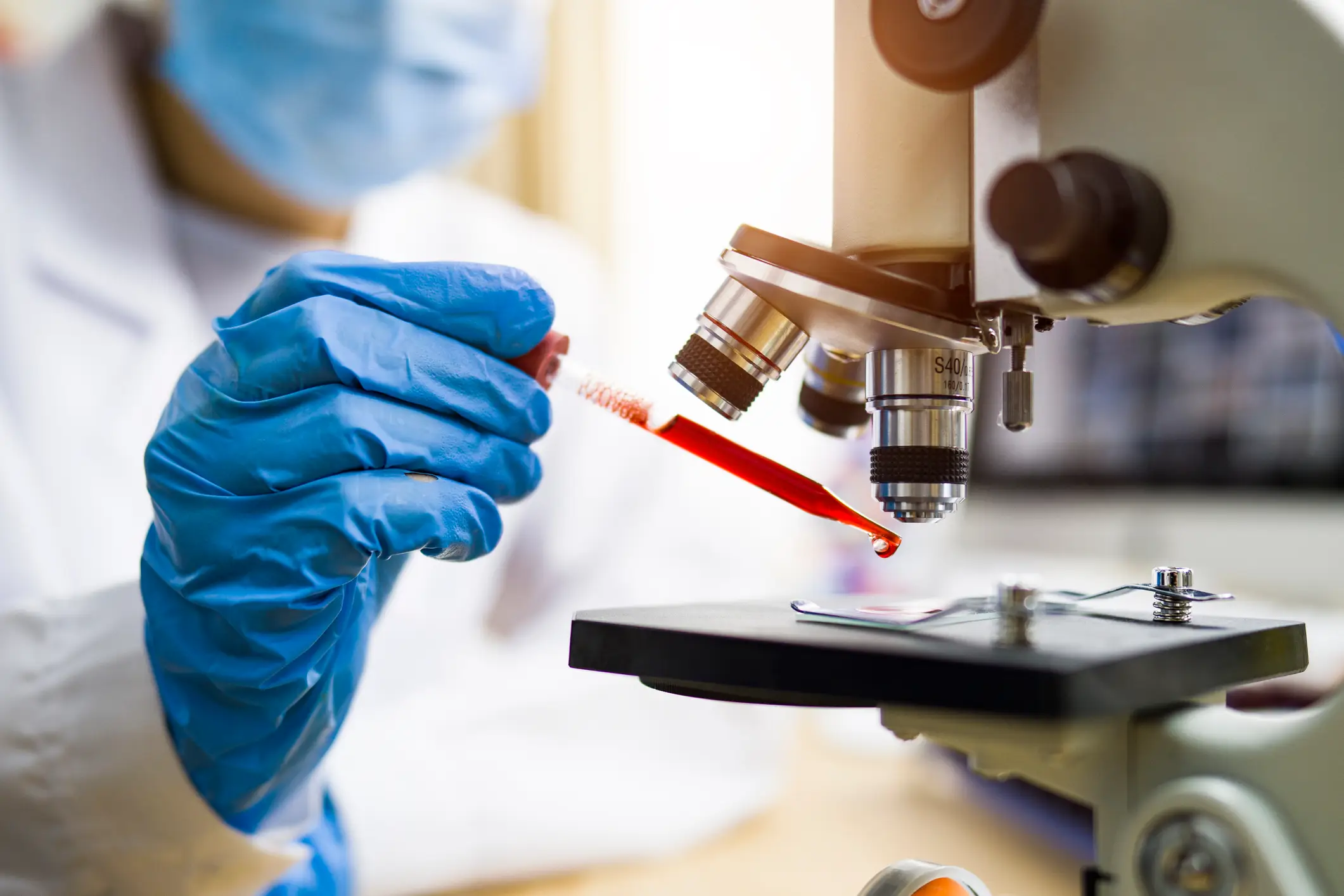 Scientists have been tracking the increase in cases linked to the practice (Getty Stock)