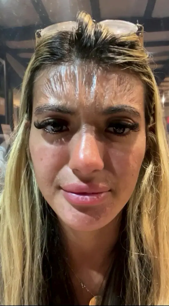 Sirin's skin was so tight it looked like plastic.