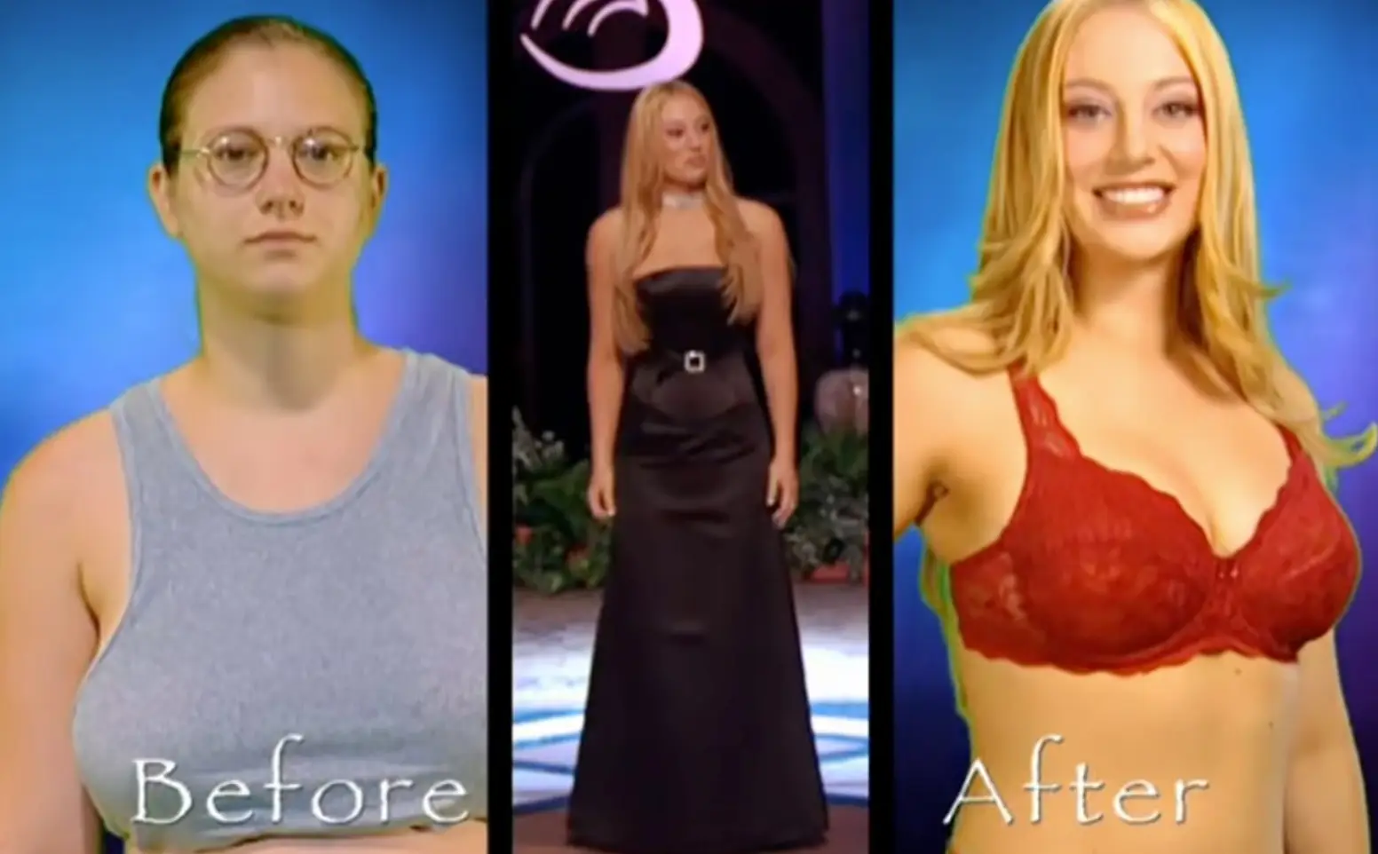 Bravata claimed she 'almost died' while under the knife (Fox)