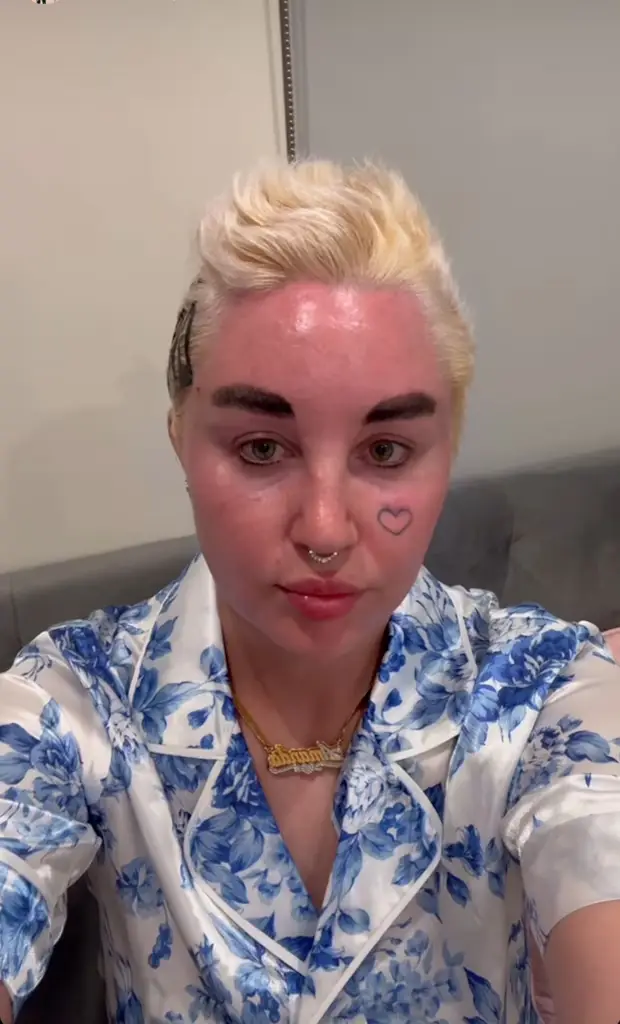 Amanda has updated fans about her health. (Instagram/amandabynes)