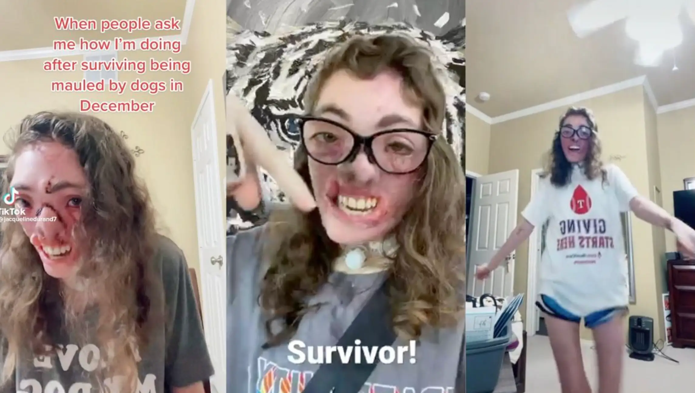 The prognosis for Durand's face regrowing is now good.