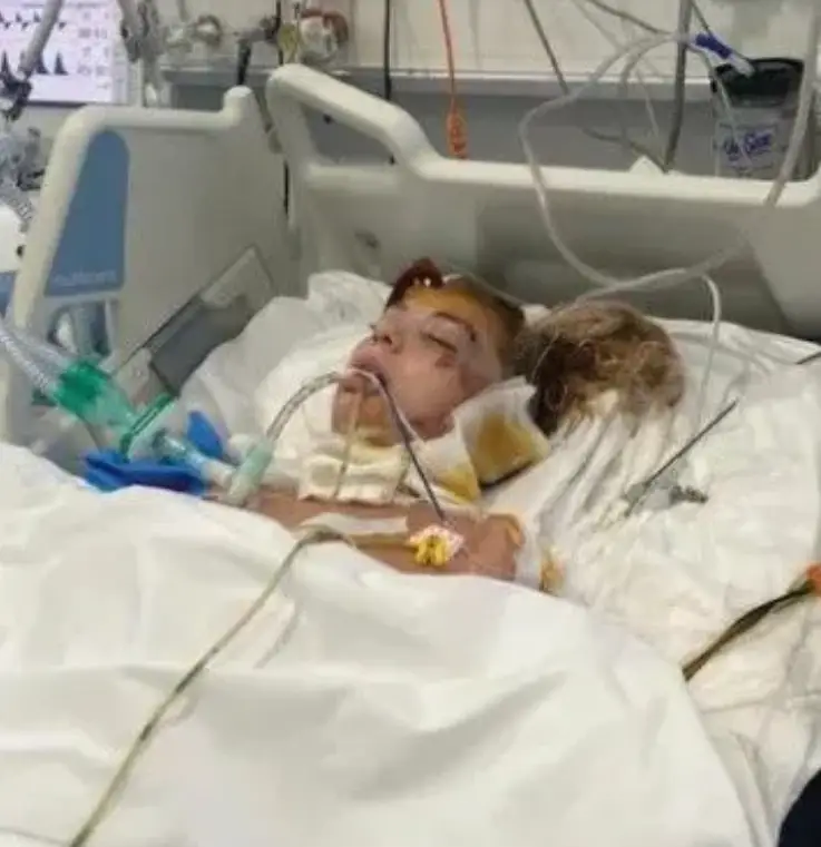 Ellie was placed into a medically induced coma as a result of her injuries.