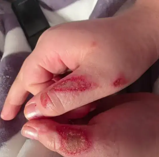 Parents have shared their concerns about the trend (CBS Chicago)