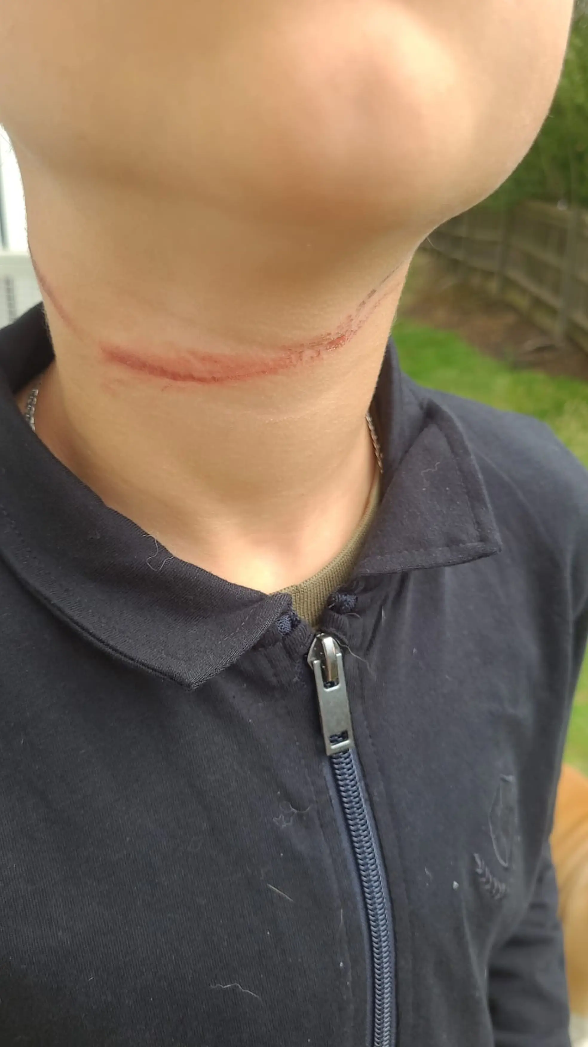 He got caught in a fly curtain last week.