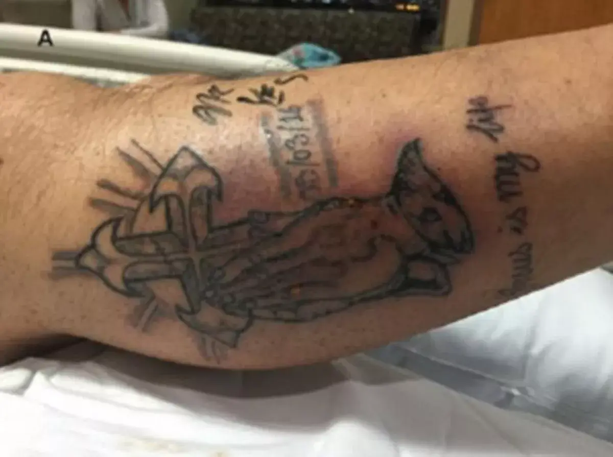 The man died after swimming with a new tattoo (BMJ Case Reports)