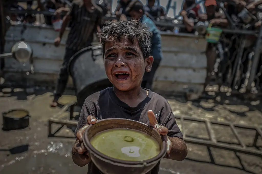 The total number of starvation deaths is now 133, which includes 87 children (Anadolu / Contributor / Getty Images)