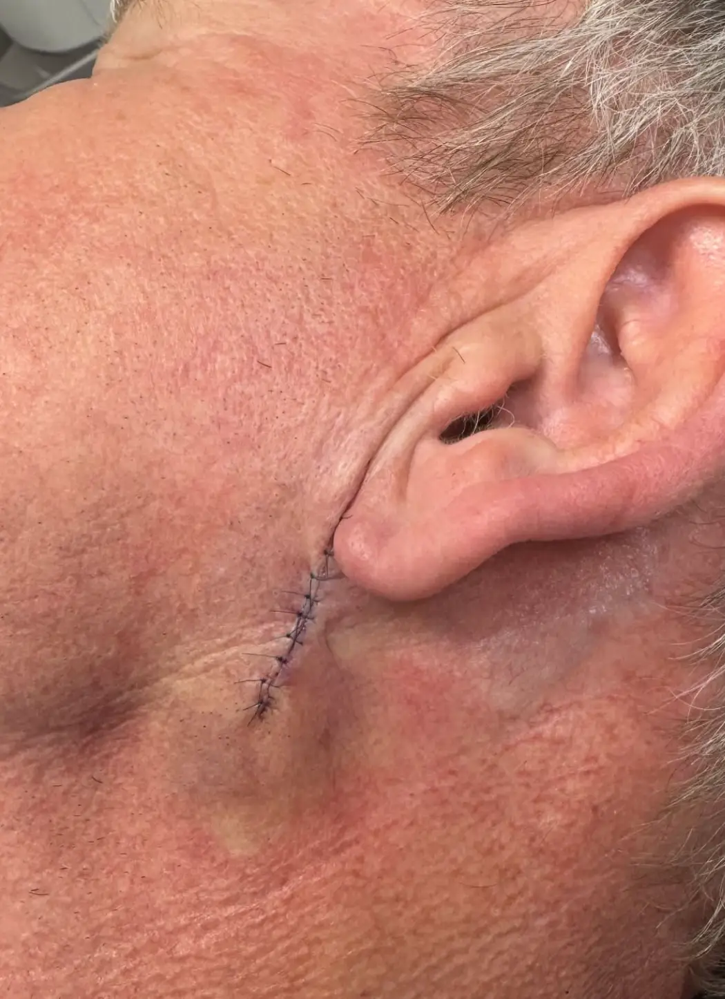 Gordon showed his followers his stitches (Instagram/@gordongram)